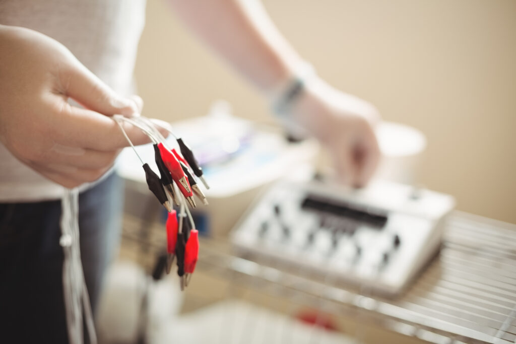 Close-up of a physiotherapist holding the cable of electro dry needling unit